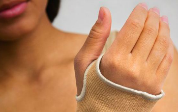 Dupuytren’s Contracture