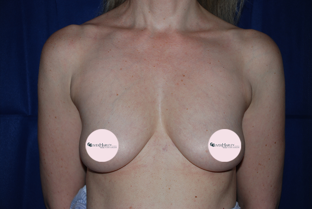 JB BBA 400 Before Front